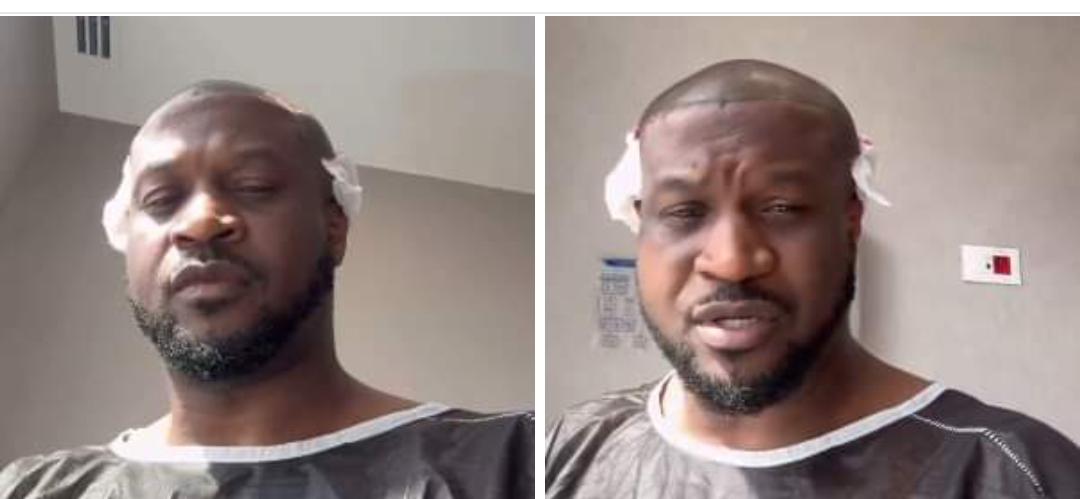 Just In : Singer Peter Okoye Undergoes Hair Transplant In Turkey